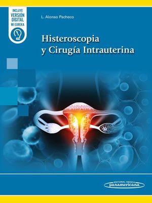 HISTEROSCOPIA Y CIRUG�A INTRAUTERINA