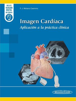 IMAGEN CARDACA