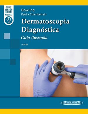 DERMATOSCOPIA DIAGNSTICA