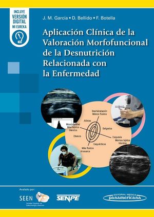 APLICACI�N CL�NICA DE LA VALORACI�N MORFOFUNCIONAL DE LA DESNUTRICI�N RELACIONAD