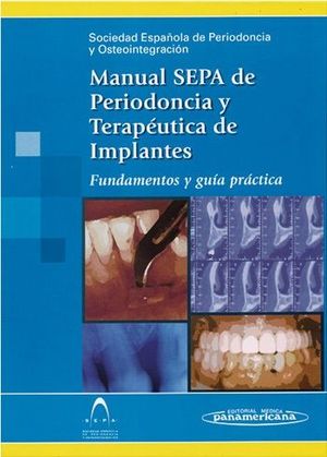 MANUAL SEPA DE PERIODONCIA Y TERAPUTICA DE IMPLANTES