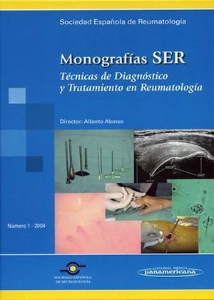 MONOGRAFIAS SER TECNICAS DE DIAGNOSTICO Y TRATAMIENTO EN REUMATOLOGIA