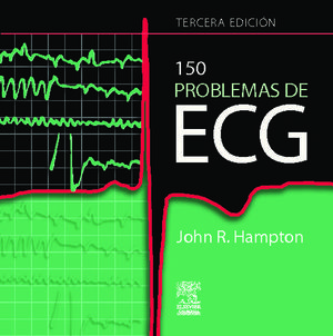 150 PROBLEMAS DE ECG 3� ED. 2009