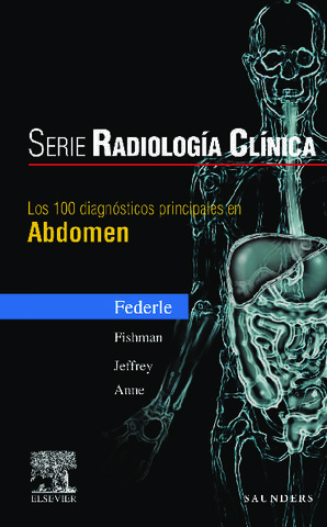 100 DIAGNOSTICOS PRINCIPALES EN ABDOMEN