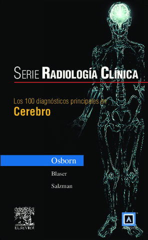 100 DIAGNOSTICOS PRINCIPALES EN CEREBRO