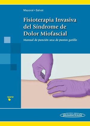 FISIOTERAPIA INVASIVA DEL SINDROME DEL DOLOR MIOFASCIAL