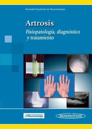 ARTROSIS