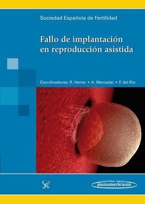 FALLO DE IMPLANTACIN EN REPRODUCCIN ASISTIDA