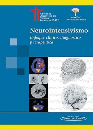 NEUROINTENSIVISMO