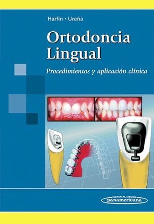 ORTODONCIA LINGUAL