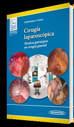 CIRUGA LAPAROSCPICA