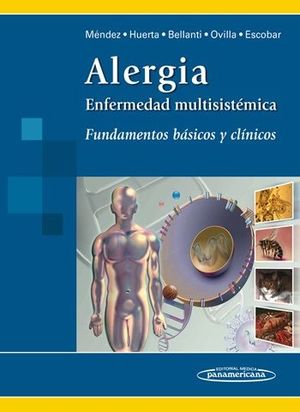 ALERGIA ENFERMEDAD MULTISISTEMICA